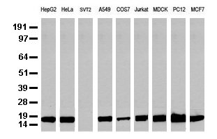 Western blot analysis of extracts (35 ug) from 9 different cell lines by using anti-NME1 monoclonal antibody (Clone UMAB91).