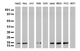 Western blot analysis of extracts (35 ug) from 9 different cell lines by using anti-NME1 monoclonal antibody (Clone UMAB92).