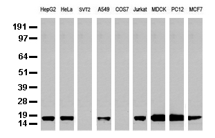 Western blot analysis of extracts (35 ug) from 9 different cell lines by using anti-NME1 monoclonal antibody (Clone UMAB93).