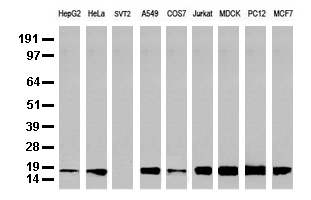 Western blot analysis of extracts (35 ug) from 9 different cell lines by using anti-NME1 monoclonal antibody (Clone UMAB94).