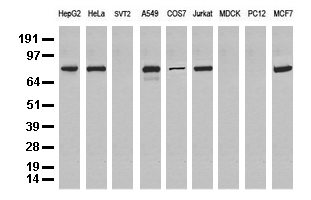 Western blot analysis of extracts (35 ug) from 9 different cell lines by using anti-NBN monoclonal antibody (Clone UMAB99).