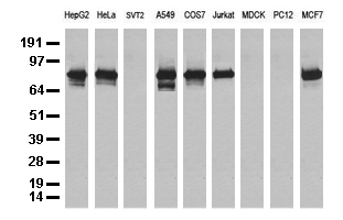 Western blot analysis of extracts (35 ug) from 9 different cell lines by using anti-NBN monoclonal antibody (Clone UMAB100).