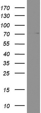 Western blot analysis of RPMI8226 cell lysate (35 ug) by using anti-PARN monoclonal antibody.