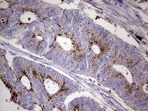 Immunohistochemical staining of paraffin-embedded Human colon tissue using anti-GBA mouse monoclonal antibody. (UM800064; heat-induced epitope retrieval by 1mM EDTA in 10mM Tris, pH8.0, 120°C for 3min)