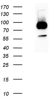 NIH-3T3 (Left lane) or stable expressed LGR5-3T3 (RC212825, Right lane) cell lysates (5 ug per lane) were separated by SDS-PAGE and immunoblotted with anti-LGR5 (1:1000).