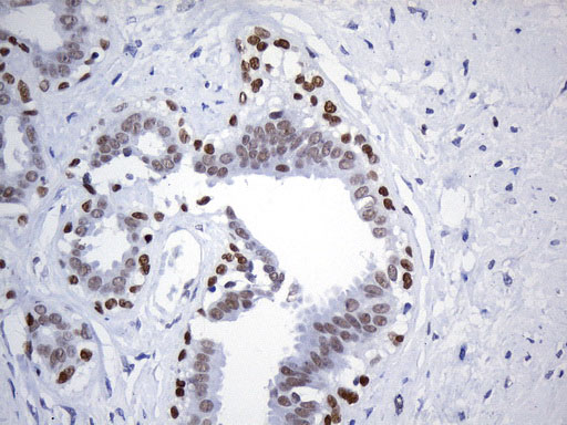 Immunohistochemical staining of paraffin-embedded Human breast tissue within the normal limits using anti-FOXP1 mouse monoclonal antibody. (Heat-induced epitope retrieval by 1mM EDTA in 10mM Tris buffer (pH8.5) at 120°C for 3min, UM800134) (1:75)