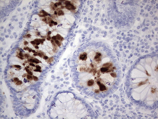 Immunohistochemical staining of paraffin-embedded Human colon tissue within the normal limits using anti-TAG 72-4 / CA 72-4 mouse monoclonal antibody. (TA190272). Heat-induced epitope retrieval by EDTA solution buffer pH 8.0 at 120°C for 3 min.