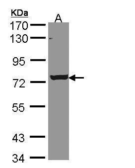 Sample (30 ug of whole cell lysate). A: A431. 7.5% SDS PAGE. TA308029 diluted at 1:5000