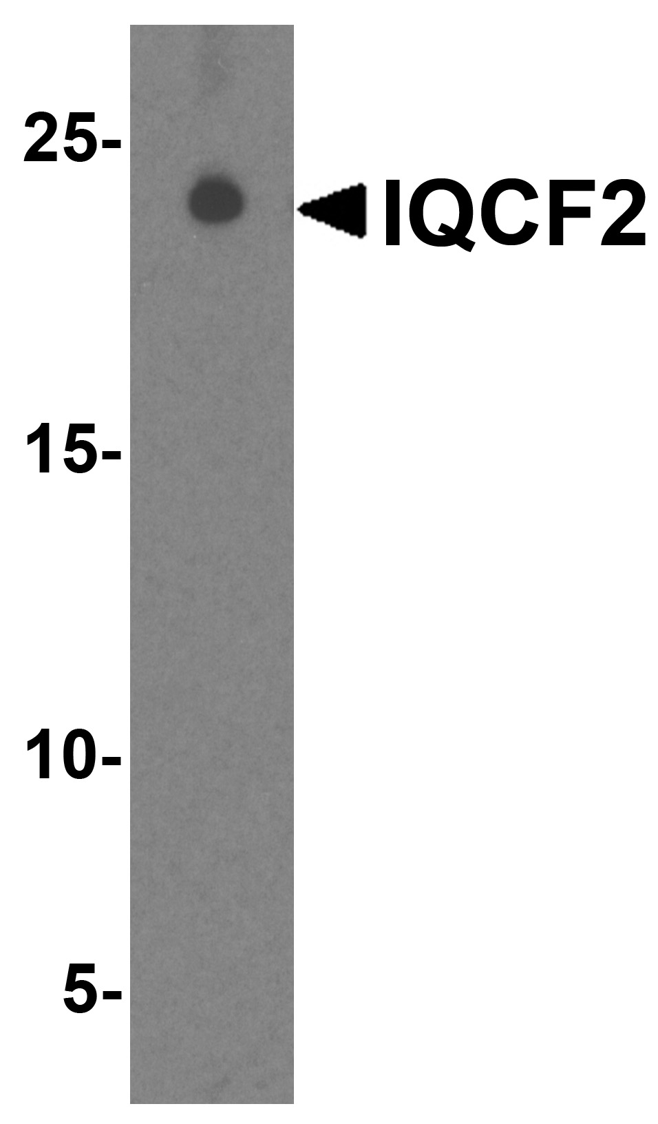 Western blot analysis of IQCF2 in human testis tissue lysate with IQCF2 antibody at 1ug/ml.