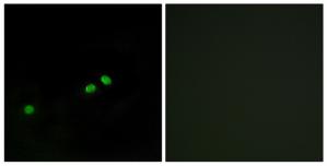 Immunofluorescence analysis of HeLa cells, using Centromeric Protein A (Phospho-Ser7) antibody.The picture on the right is treated with the synthesized peptide.