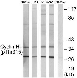 Western blot analysis of extracts from HepG2 cells, JK cells, HuvEc cells and A549 cells, using Cyclin H (Phospho-Thr315) antibody.The lane on the right is treated with the synthesized peptide.