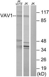 Western blot analysis of extracts from Jurkat cells, using VAV1 (Ab-174) Antibody.The lane on the right is treated with the synthesized peptide.