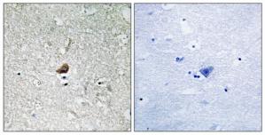 Immunohistochemistry analysis of paraffin-embedded human brain tissue using IRAK1 antibody.The picture on the right is treated with the synthesized peptide.