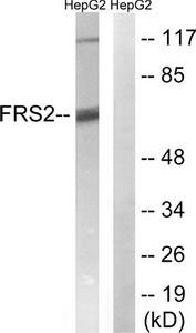 Western blot analysis of extracts from HepG2 cells, using FRS2 (Ab-196) antibody.The lane on the right is treated with the synthesized peptide.