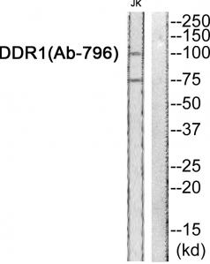 Western blot analysis of extracts from Jurket cells, using DDR1 (Ab-796) antibody.