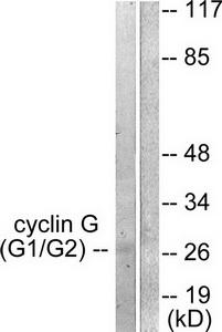 Western blot analysis of extracts from Jurkat cells, using Cyclin G antibody (#TA313571).The lane on the right is treated with the synthesized peptide.