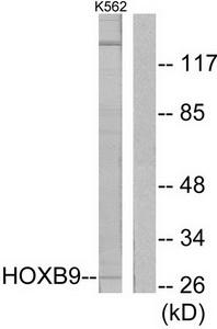Western blot analysis of extracts from K562 cells, using HOXB9 antibody.The lane on the right is treated with the synthesized peptide.