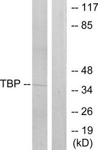Western blot analysis of extracts from 293 cells, using TBP antibody.The lane on the right is treated with the synthesized peptide.
