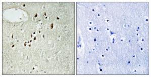 Immunohistochemistry analysis of paraffin-embedded human brain tissue, using EMX2 antibody.The picture on the right is treated with the synthesized peptide.