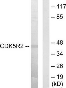 Western blot analysis of extracts from HUVEC cells, using CDK5R2 antibody.The lane on the right is treated with the synthesized peptide.