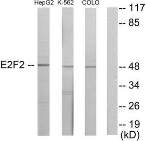 Western blot analysis of extracts from HepG2 cells, K562 cells and COLO205 cells, using E2F2 antibody.The lane on the right is treated with the synthesized peptide.