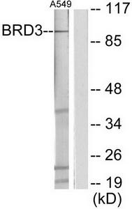 Western blot analysis of extracts from A549 cells, using BRD3 antibody.The lane on the right is treated with the synthesized peptide.