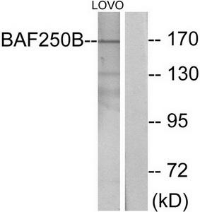 Western blot analysis of extracts from LOVO cells, using BAF250B antibody.The lane on the right is treated with the synthesized peptide.
