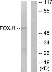 Western blot analysis of extracts from LOVO cells, using FOXJ1 antibody.The lane on the right is treated with the synthesized peptide.
