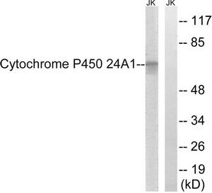 Western blot analysis of extracts from HUVEC cells, using Cytochrome P450 24A1 antibody.The lane on the right is treated with the synthesized peptide.