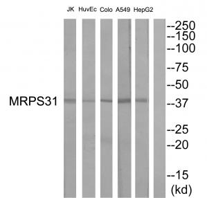 Western blot analysis of extracts from HepG2 cells, A549 cells, COLO cells, HuvEc cells and JurKat cells, using MRPS31 antibody.The lane on the right is treated with the synthesized peptide.
