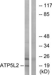 Western blot analysis of extracts from A549 cells, using ATP5L2 antibody.The lane on the right is treated with the synthesized peptide.