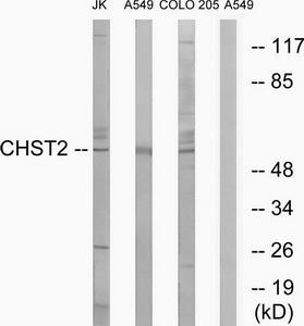 Western blot analysis of extracts from Jurkat cells, A549 cells and COLO cells, using CHST2 antibody.The lane on the right is treated with the synthesized peptide.
