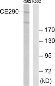 Western blot analysis of extracts from K562 cells, using CEP290 antibody.The lane on the right is treated with the synthesized peptide.