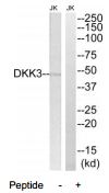 Western blot analysis of extracts from Jurkat cells, using DDK3 antibody.