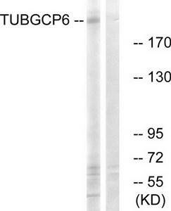 Western blot analysis of extracts from COLO cells, using TUBGCP6 antibody.The lane on the right is treated with the synthesized peptide.