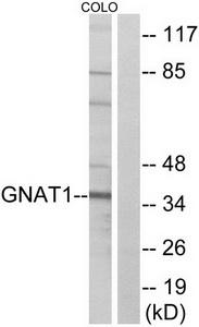 Western blot analysis of extracts from COLO cells, using GNAT1 antibody.The lane on the right is treated with the synthesized peptide.