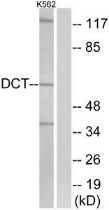 Western blot analysis of extracts from K562 cells, using DCT antibody.The lane on the right is treated with the synthesized peptide.