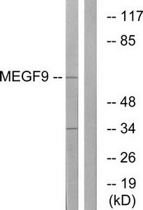 Western blot analysis of extracts from COLO cells, using MEGF9 antibody.The lane on the right is treated with the synthesized peptide.