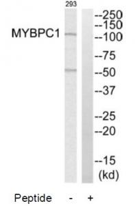 Western blot analysis of extracts from 293 cells, using MYBPC1 antibody.The lane on the right is treated with the synthesized peptide.