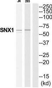Western blot analysis of extracts from Jurkat/293 cells, using SNX1 antibody.The lane on the right is treated with the synthesized peptide.