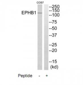 Western blot analysis of extracts from COS7 cells, using EPHB1 antibody.The lane on the right is treated with the synthesized peptide.