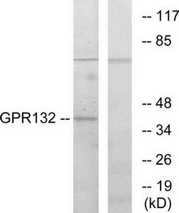 Western blot analysis of extracts from COS-7 cells, using GPR132 antibody.The lane on the right is treated with the synthesized peptide.