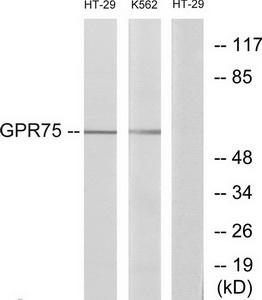 GPR75 Rabbit Polyclonal Antibody | TA315128 | OriGene Technologies Inc.