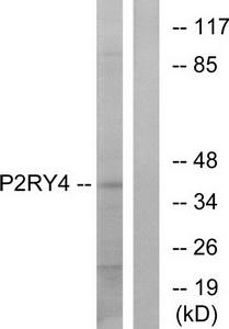 Western blot analysis of extracts from HeLa cells, using P2RY4 antibody.The lane on the right is treated with the synthesized peptide.