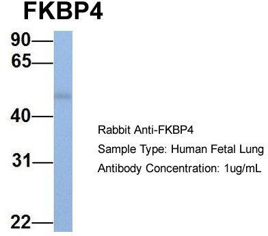 Host: Rabbit; Target Name: FKBP4; Sample Tissue: Human Fetal Lung; Antibody Dilution: 1.0ug/ml