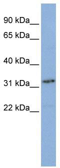 WB Suggested Anti-SNAPC2 Antibody Titration: 0.2-1 ug/ml; ELISA Titer: 1:1562500; Positive Control: Jurkat cell lysate