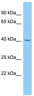 WB Suggested Anti-EN2 Antibody Titration: 0.05ug/ml; ELISA Titer: 1:2500; Positive Control: Human cerebellum