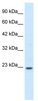WB Suggested Anti-HOXB6 Antibody Titration: 0.2-1 ug/ml; ELISA Titer: 1:12500; Positive Control: Human Intestine