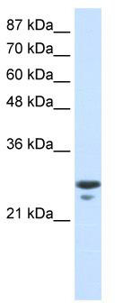 WB Suggested Anti-TFAM Antibody Titration: 0.2-1 ug/ml; ELISA Titer: 1:1562500; Positive Control: Jurkat cell lysate