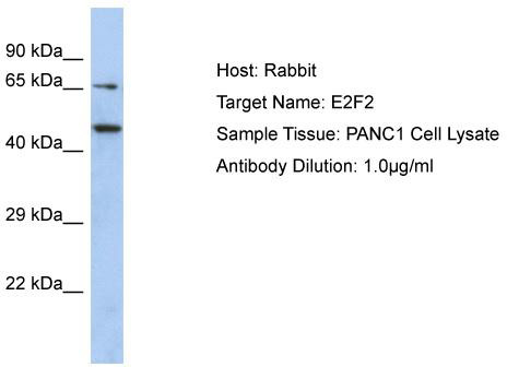 Host: Rabbit; Target Name: E2F2; Sample Tissue: PANC1 Whole Cell lysates; Antibody Dilution: 1.0ug/ml